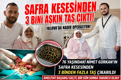 SAFRA KESESİNDEN 3 BİNİ AŞKIN TAŞ ÇIKTI!