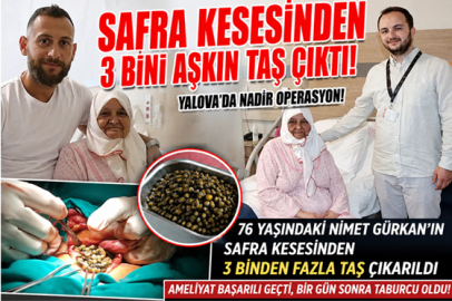 SAFRA KESESİNDEN 3 BİNİ AŞKIN TAŞ ÇIKTI!